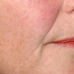 non surgical cosmetic surgery scotland